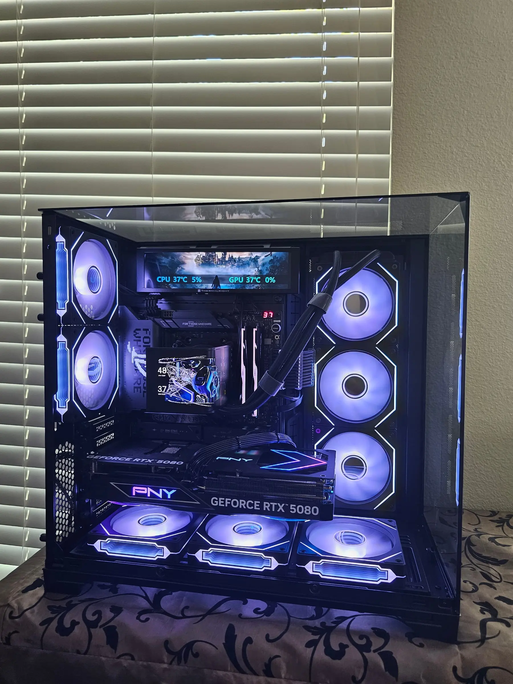 O11 Vision front-on in ice white — Trofeo Vision strip showing Hogwarts art with live temps above the TRYX AMOLED and PNY RTX 5080